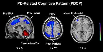 Correlations of Neuropsychological and Metabolic Brain Changes in Parkinson's Disease and Other α-Synucleinopathies